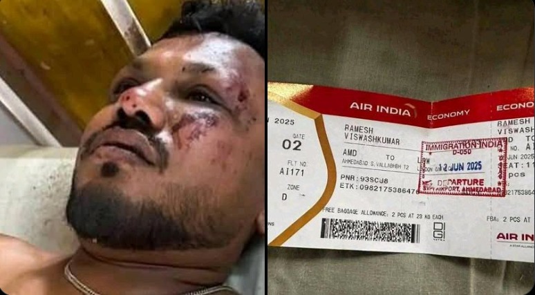 Kisah Mukjizat Ramesh, Satu-satunya Penumpang Selamat Tragedi Air India